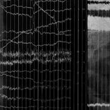 Artwork for "Sternum X"