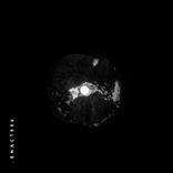 Portada para "Burden"