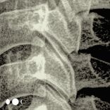 Artwork for "No Karma"