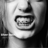 Silver teeth