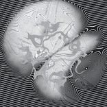 Inherent Differences