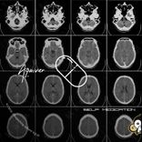 Artwork for "Self Medication"