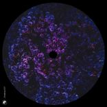 Artwork for "I Lost a Friend"