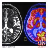 Artwork for "In My Mind"