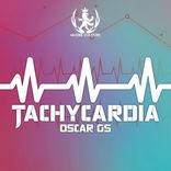 Tachycardia