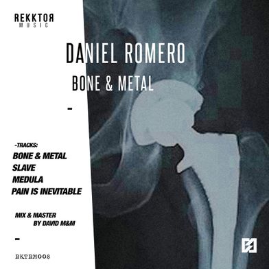 Bone and Metal